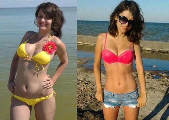 Anna NexaSlim ile 10 kilo verdi